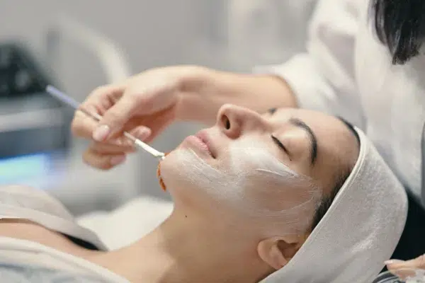 peeling quimico